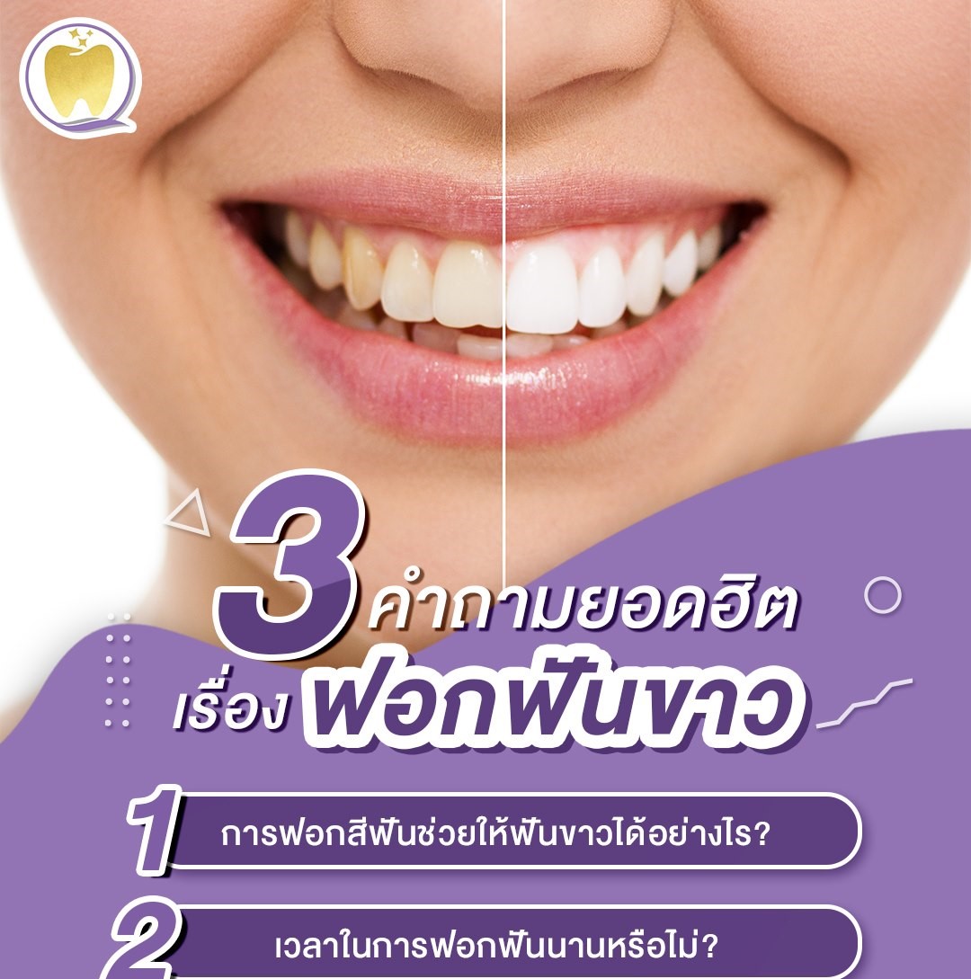 ฟอกสีฟัน (ทุกวัน)