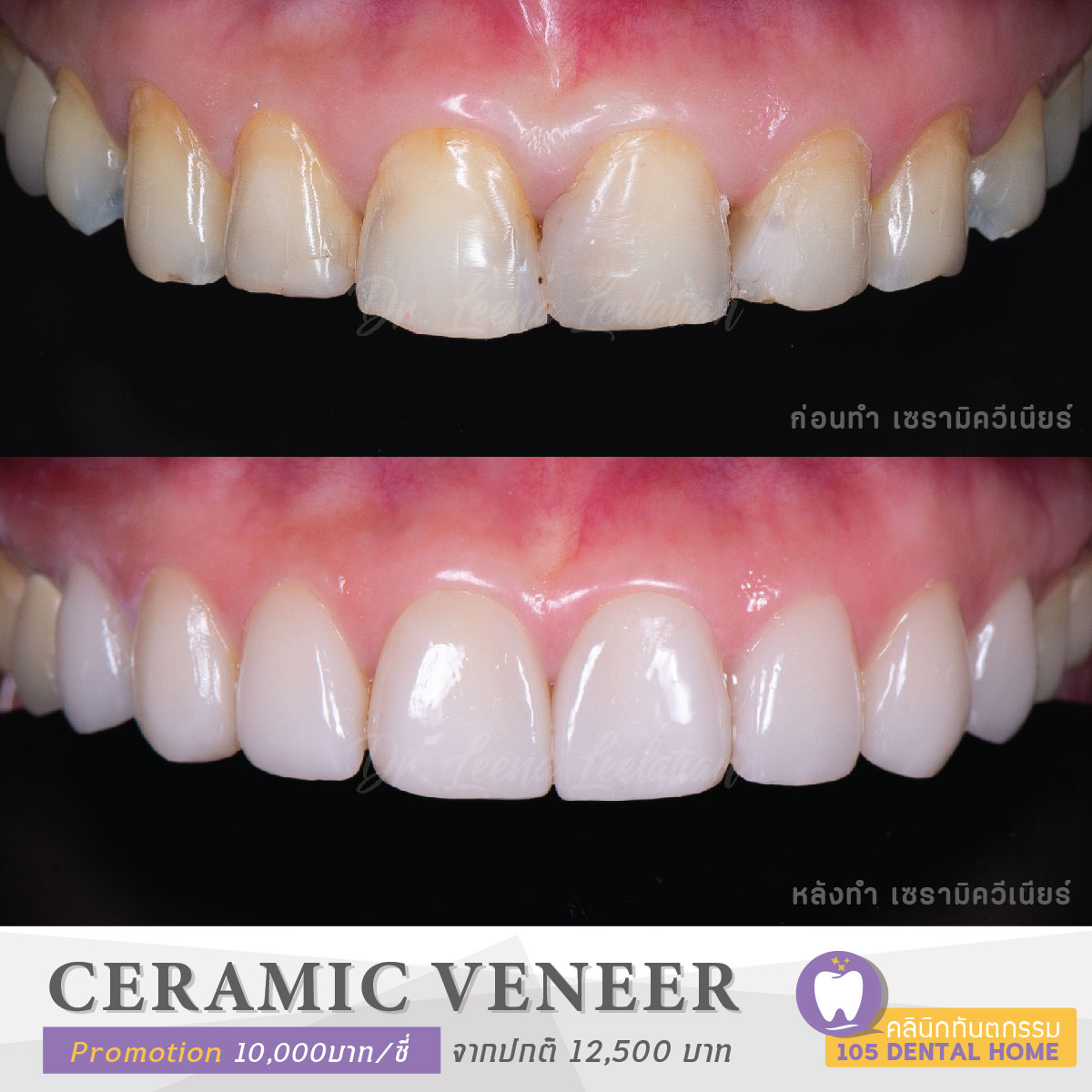 วีเนียร์ (วันอาทิตย์)