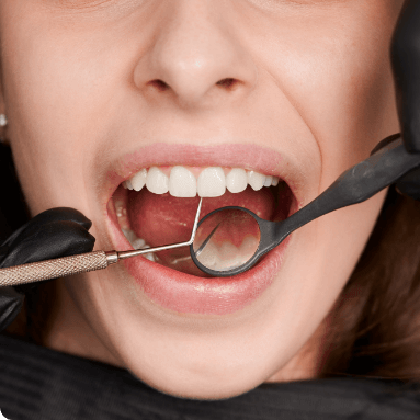 รักษาโรคปริทันต์ (วันพุธ)